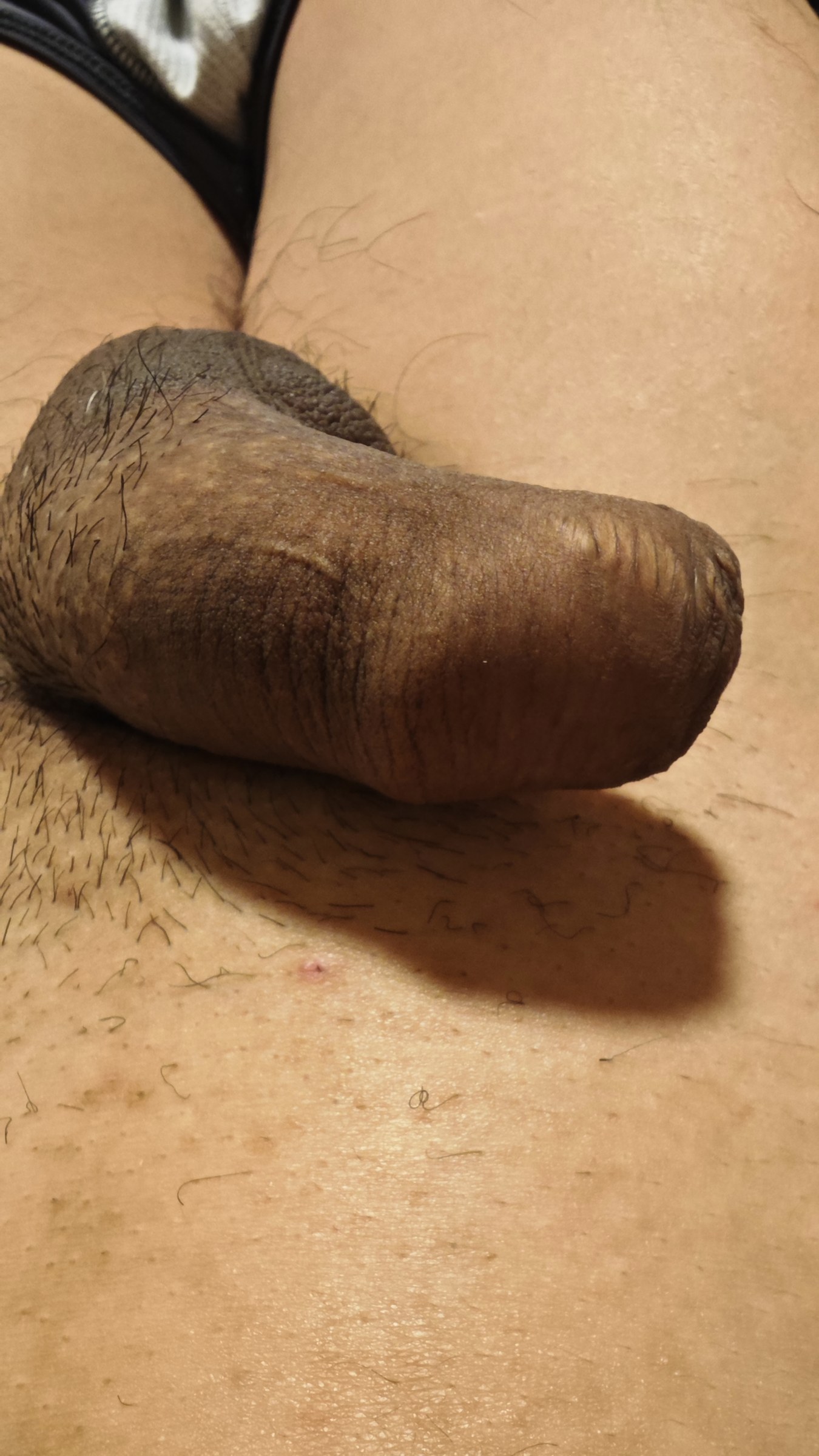 包茎